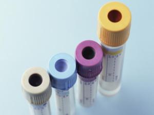 blood-test-tubes